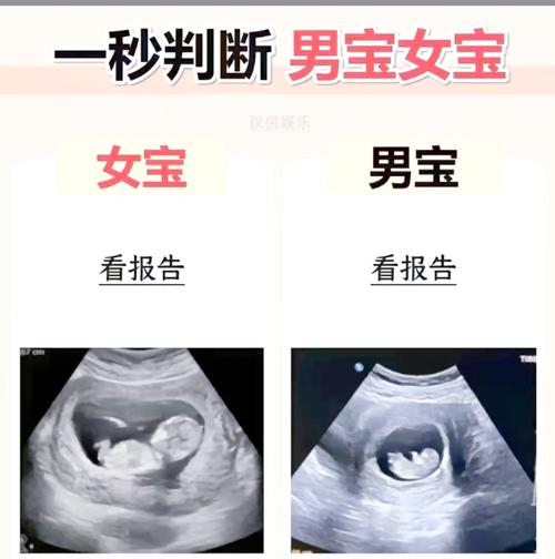 孕期食量暴增真能预示宝宝性别？科学依据还是民间传说？-第1张图片-郑州医学网