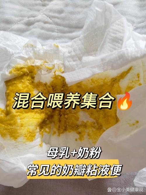 新生儿大便中有奶瓣是正常现象吗？需要担心或处理吗？-第3张图片-郑州医学网