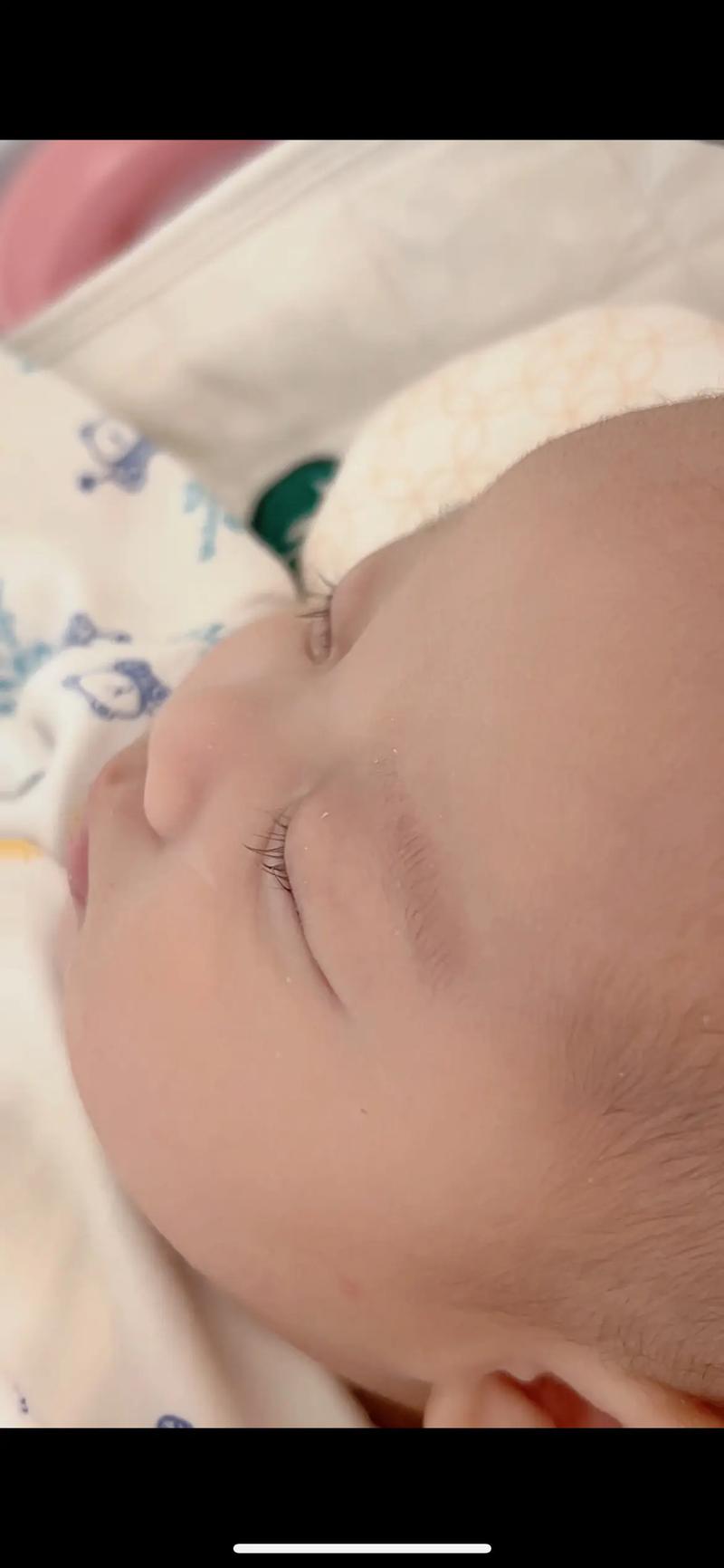 新生儿睫毛到底什么时候长？出生时就有还是后来慢慢长？影响睫毛生长的因素有哪些？-第2张图片-郑州医学网