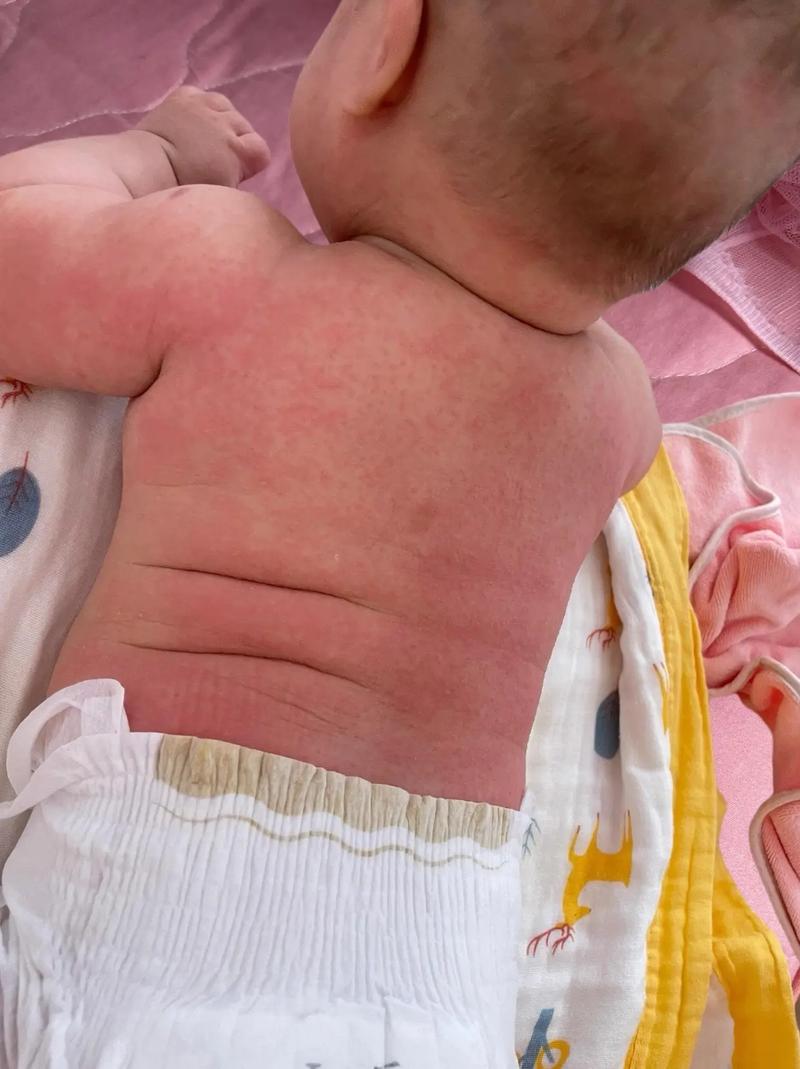 新生儿肚子摸着热是正常现象还是生病信号?需要警惕哪些问题?-第2张图片-郑州医学网 新生儿肚子摸着热是正常现象还是生病信号?需要警惕哪些问题?-第2张图片-郑州医学网