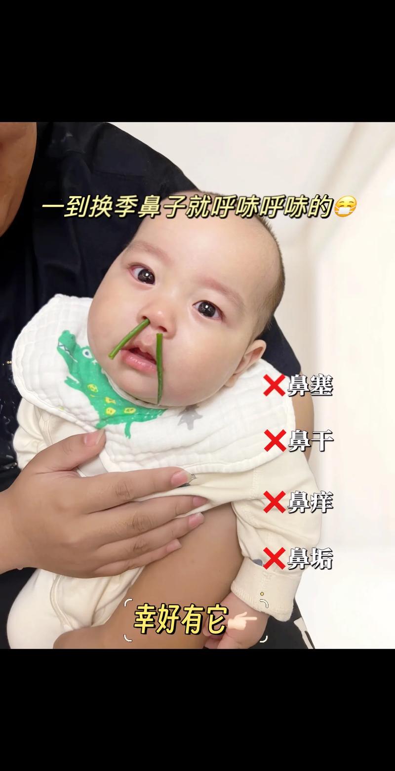 新生儿鼻塞期间能否正常接种疫苗？需先处理鼻塞还是直接接种？-第1张图片-郑州医学网