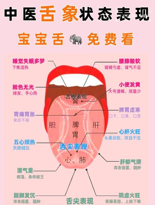 新生儿舌苔厚是正常现象还是疾病信号？该如何正确处理？-第1张图片-郑州医学网