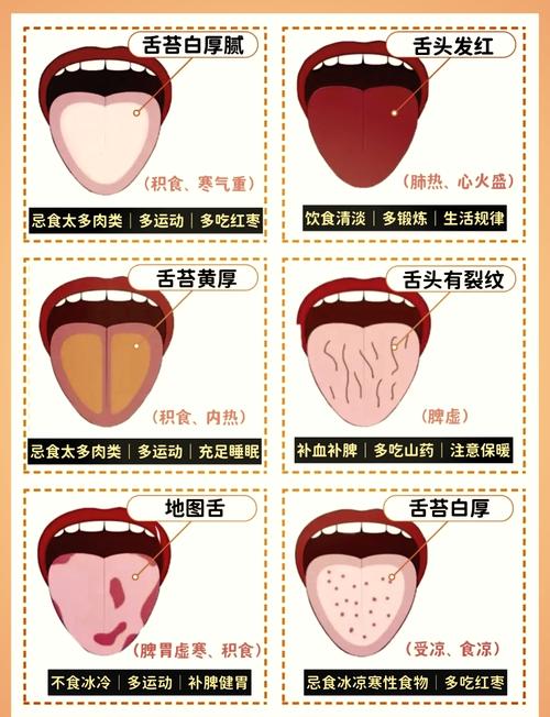 新生儿舌苔厚是正常现象还是疾病信号？该如何正确处理？-第2张图片-郑州医学网