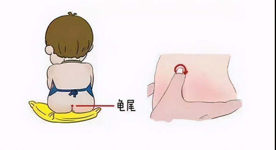 新生儿尾椎骨凹陷怎么办？家长必知的成因、护理与就医指南-第3张图片-郑州医学网