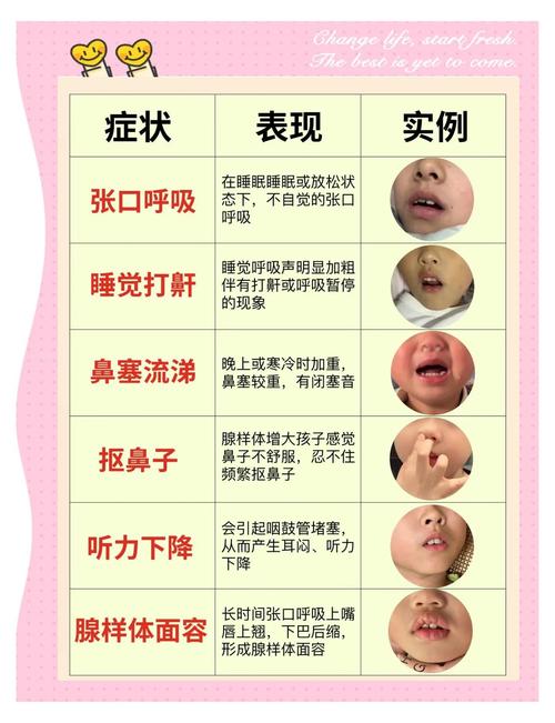 新生儿胳膊一响就哭闹是脱臼还是发育问题?需要警惕哪些异常信号?-第1张图片-郑州医学网 新生儿胳膊一响就哭闹是脱臼还是发育问题?需要警惕哪些异常信号?-第1张图片-郑州医学网