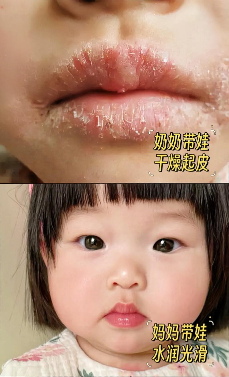 新生儿喝母乳嘴唇干是缺水还是其他原因？如何正确护理？-第2张图片-郑州医学网