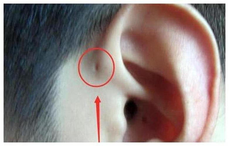 新生儿耳仓会藏污纳垢吗？日常护理要注意哪些细节才能避免感染？-第2张图片-郑州医学网