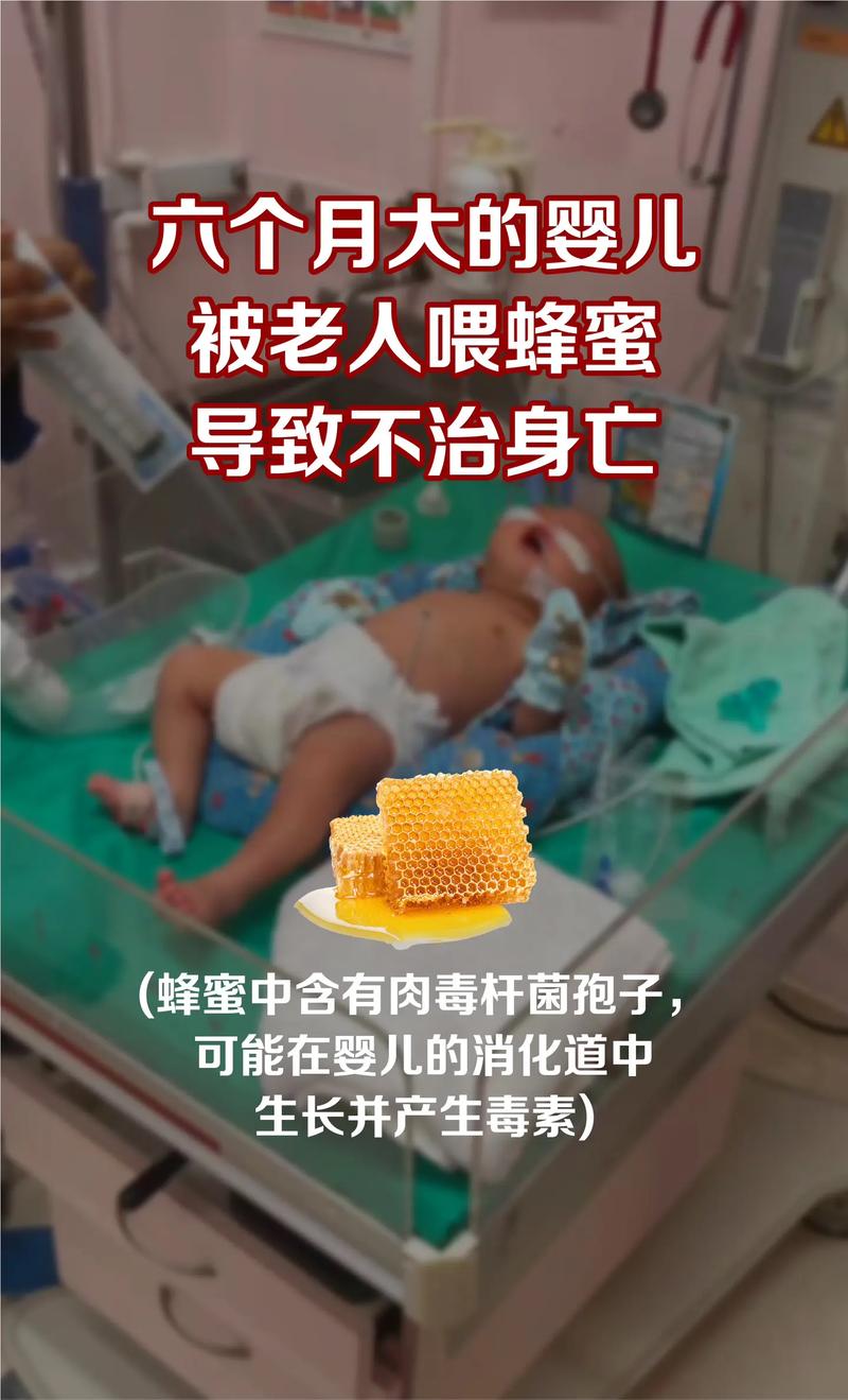 新生儿误食蜂蜜后，家长该如何正确处理？需要紧急就医吗？-第1张图片-郑州医学网