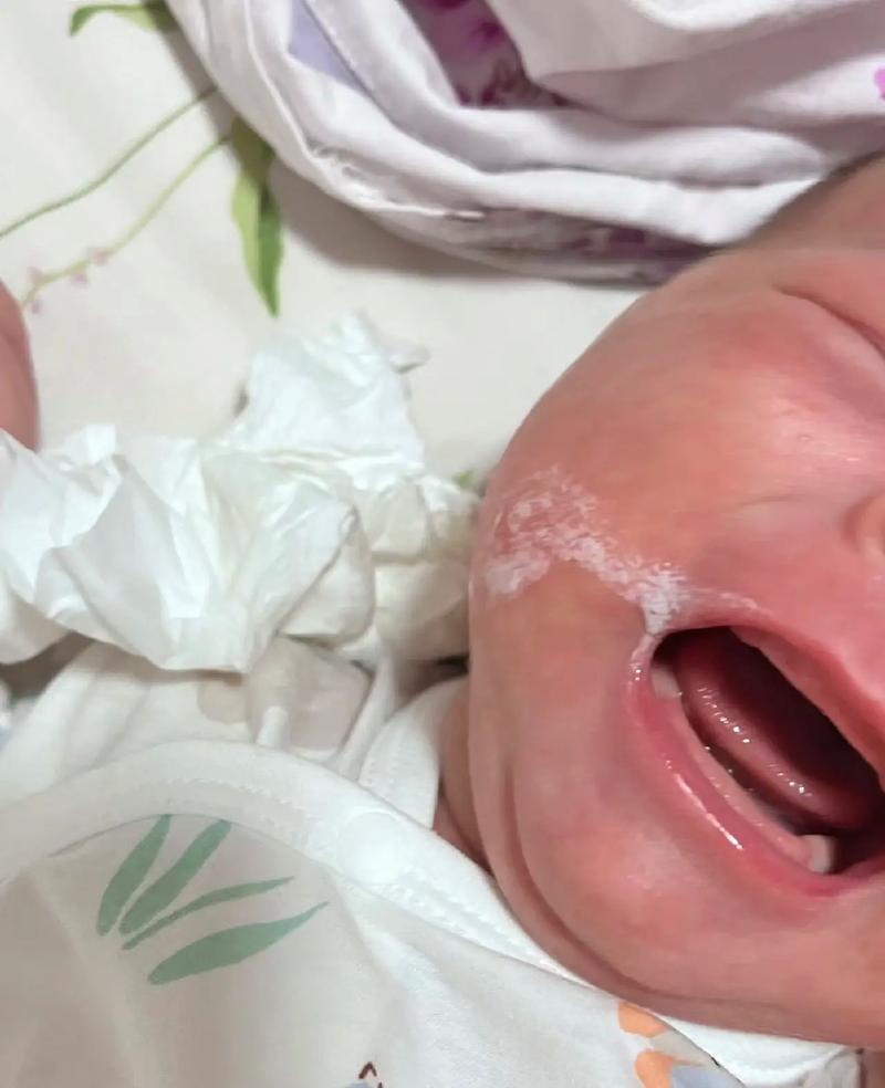 新生儿鼻子溢奶是正常现象吗？需要担心或处理吗？-第1张图片-郑州医学网