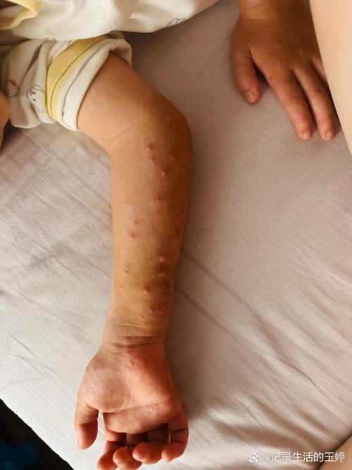 新生儿手足徐动症有哪些具体表现？家长该如何早期识别与应对？-第3张图片-郑州医学网