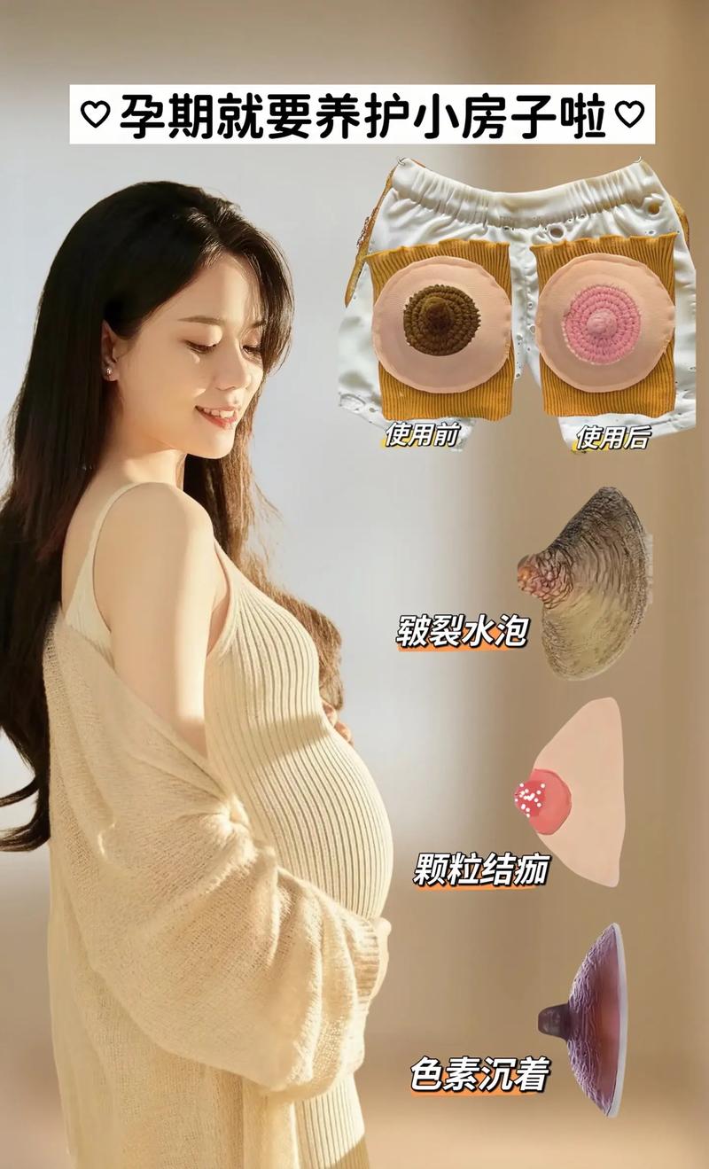 孕期乳房增大真能判断胎儿性别吗？科学依据在哪里？-第2张图片-郑州医学网