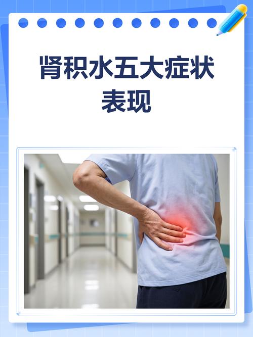 孕期肾积水常见症状有哪些？腰酸背痛、尿频尿急、下肢水肿是否需警惕？-第2张图片-郑州医学网