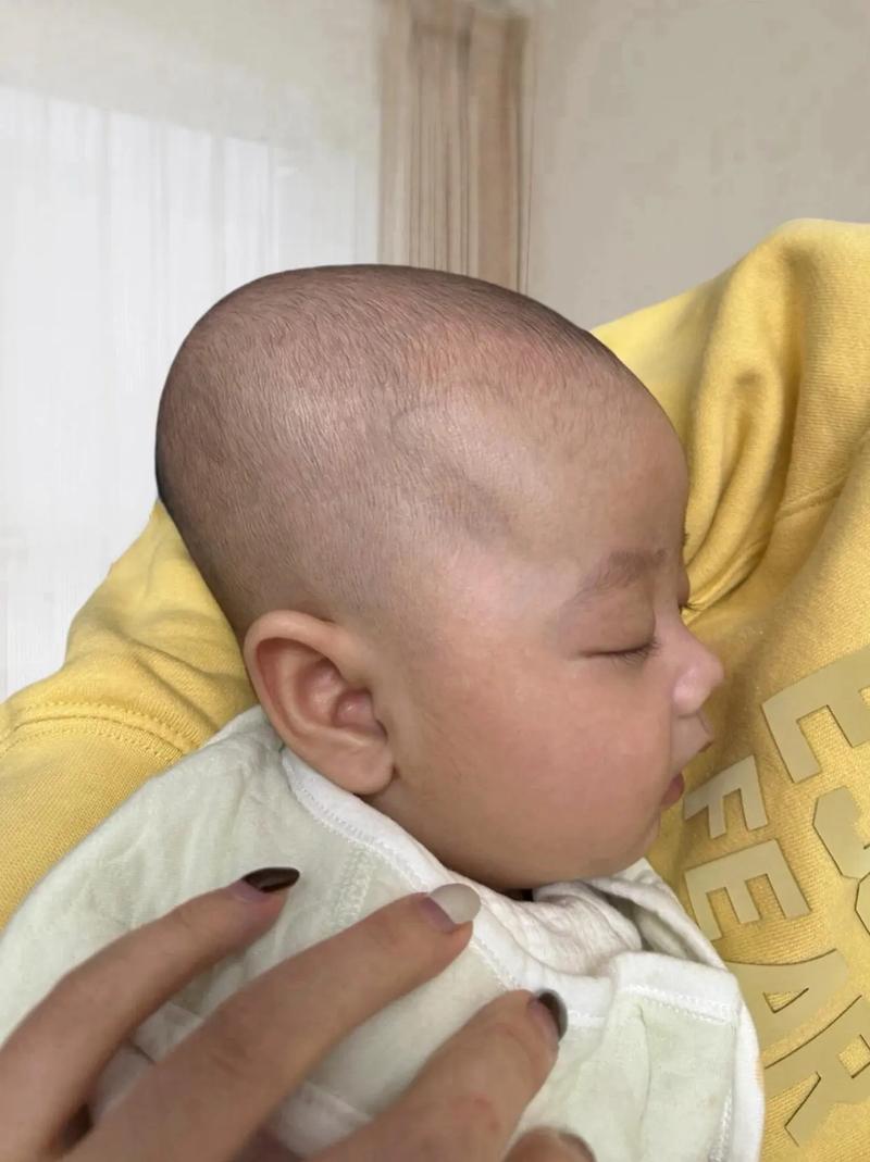 新生儿后脑勺突出是正常现象吗?附图片解析需注意哪些问题?-第3张图片-郑州医学网 新生儿后脑勺突出是正常现象吗?附图片解析需注意哪些问题?-第3张图片-郑州医学网