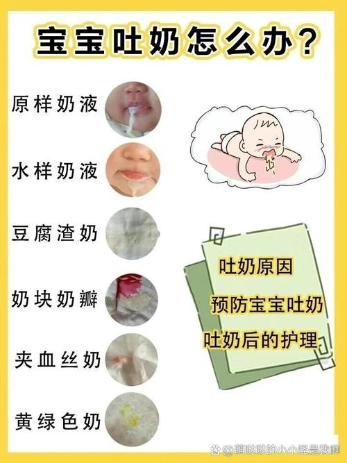 新生儿黄疸引发吐奶，是肝脏代谢异常还是胃肠功能紊乱所致？-第2张图片-郑州医学网