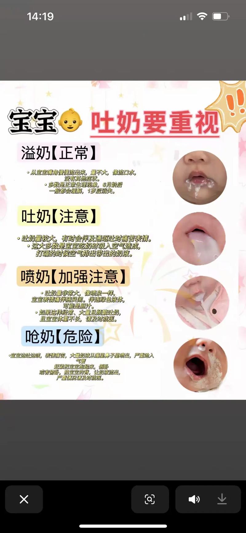 新生儿黄疸引发吐奶，是肝脏代谢异常还是胃肠功能紊乱所致？-第3张图片-郑州医学网