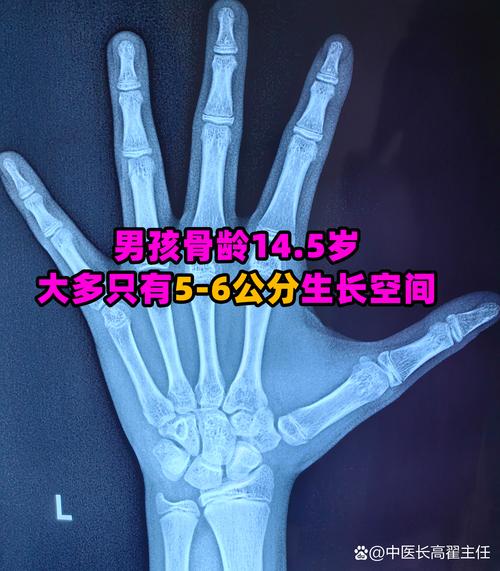 儿童年龄界定标准是怎样的？不同国家或机构对儿童年龄范围有何差异？-第2张图片-郑州医学网