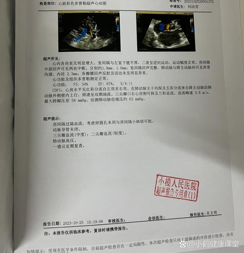 新生儿肺动脉高压的诊断标准具体包含哪些核心指标与临界值？-第2张图片-郑州医学网