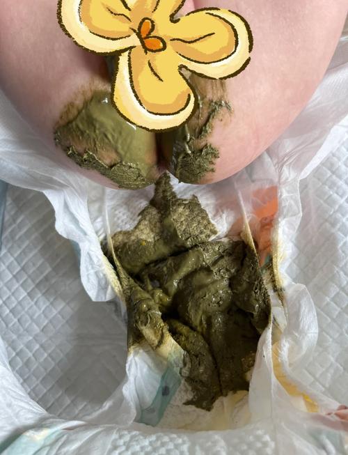 新生儿吃牛奶后不拉粑粑，是消化不良还是奶粉选错了？-第1张图片-郑州医学网