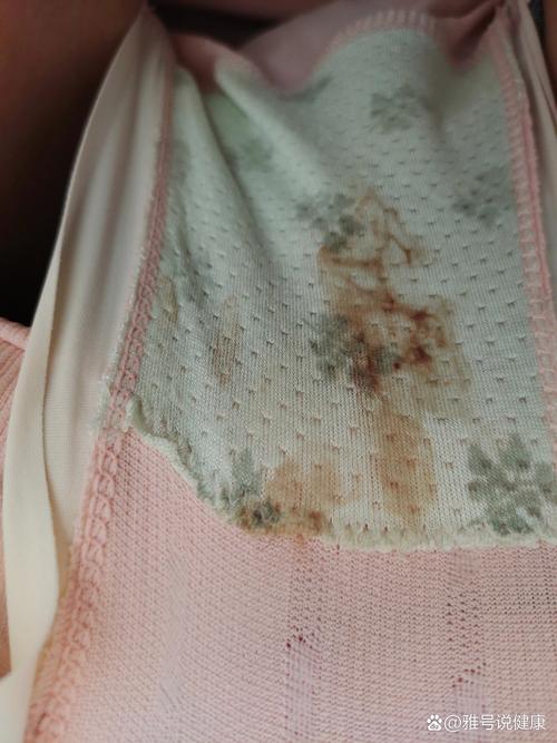 孕期白带发红又不像血-第1张图片-郑州医学网