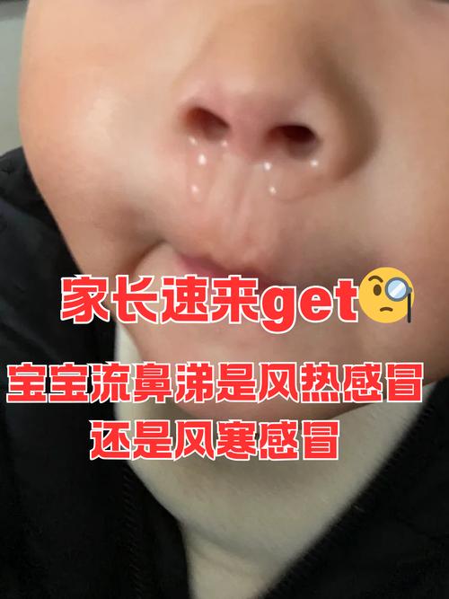 新生儿咳嗽鼻塞不发烧，是正常生理反应还是潜藏健康问题？-第3张图片-郑州医学网