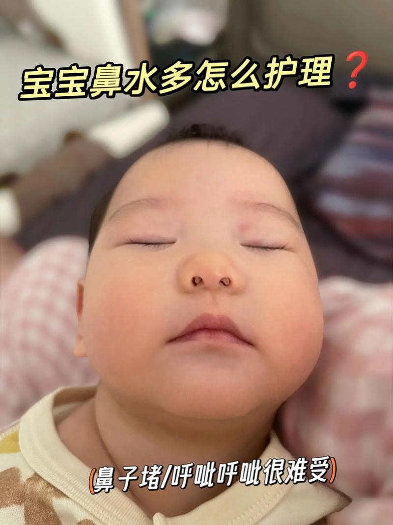 新生儿呼吸鼻子总呼呼响是正常现象还是生病了？-第2张图片-郑州医学网