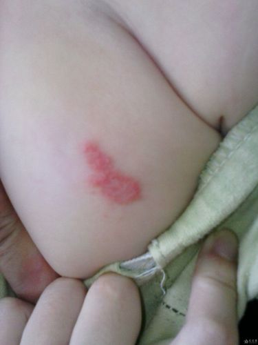 新生儿大腿摸到硬块是正常现象还是疾病信号？需要警惕哪些潜在问题？-第1张图片-郑州医学网