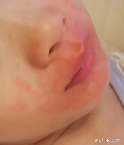 儿童烟雾病早期症状有哪些容易被忽视的信号?家长该如何识别?-第1张图片-郑州医学网 儿童烟雾病早期症状有哪些容易被忽视的信号?家长该如何识别?-第1张图片-郑州医学网