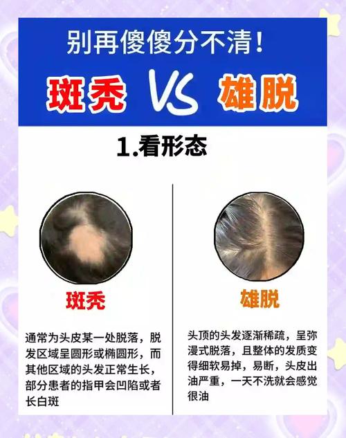 孕期斑秃的幕后推手有哪些？激素波动还是营养缺口在作祟？-第2张图片-郑州医学网