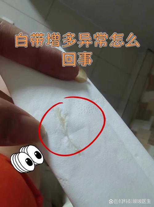 孕期白带拉丝是正常生理反应还是异常信号?需警惕哪些潜在风险?-第2张图片-郑州医学网 孕期白带拉丝是正常生理反应还是异常信号?需警惕哪些潜在风险?-第2张图片-郑州医学网