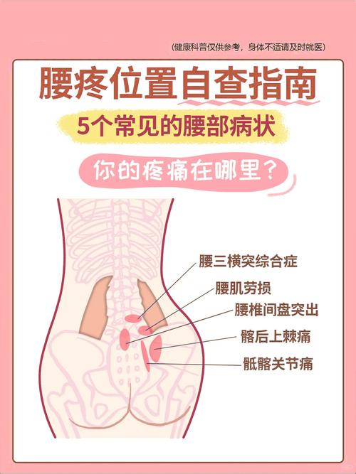 儿童腰痛背后隐藏着哪些容易被忽视的健康隐患？-第3张图片-郑州医学网