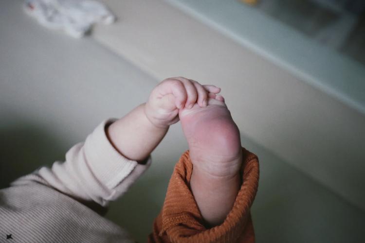 新生儿剪刀脚图片大全,剪刀脚是脑瘫信号吗?正常与异常区别在哪里?-第1张图片-郑州医学网 新生儿剪刀脚图片大全,剪刀脚是脑瘫信号吗?正常与异常区别在哪里?-第1张图片-郑州医学网