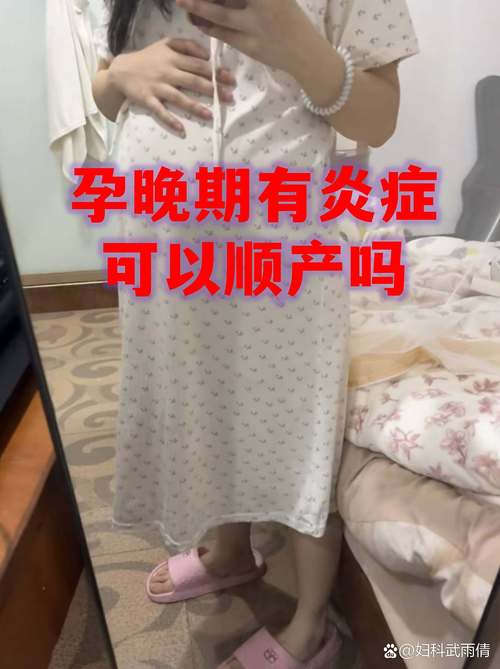 孕期霉菌感染会影响顺产吗？如何处理才能顺利分娩？-第1张图片-郑州医学网