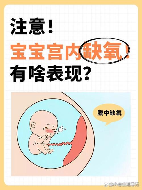 新生儿缺氧要治疗多久-第1张图片-郑州医学网 新生儿缺氧要治疗多久-第1张图片-郑州医学网