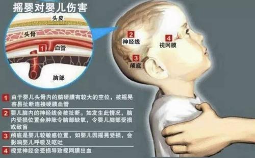 新生儿头颅血肿有何特点?如何识别与科学护理?-第1张图片-郑州医学网 新生儿头颅血肿有何特点?如何识别与科学护理?-第1张图片-郑州医学网