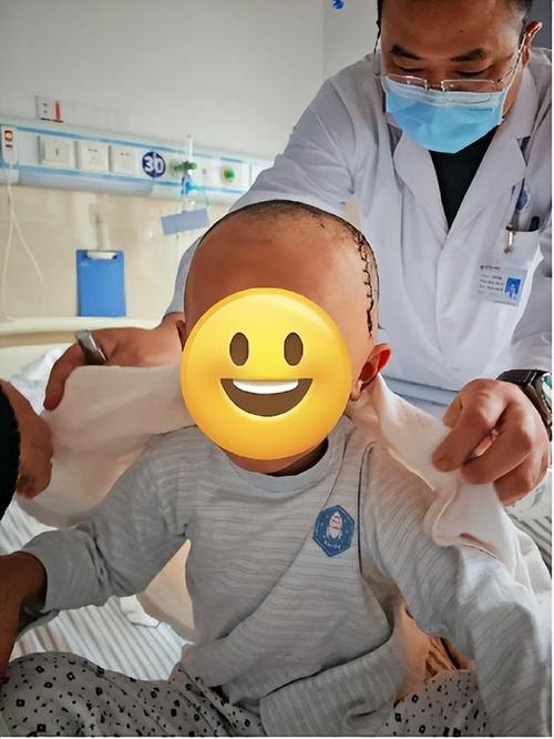 新生儿头颅血肿有何特点？如何识别与科学护理？-第3张图片-郑州医学网