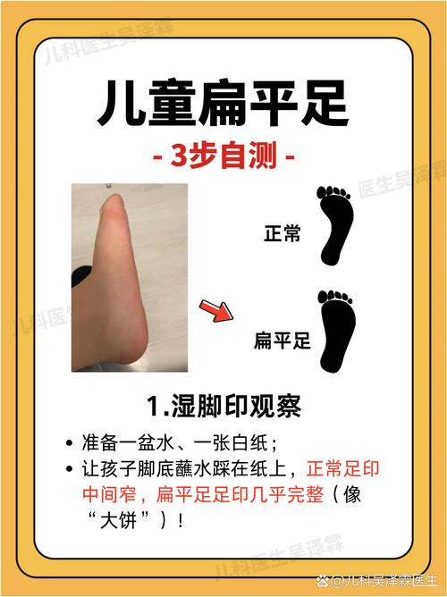 儿童平足最佳矫正时间-第2张图片-郑州医学网