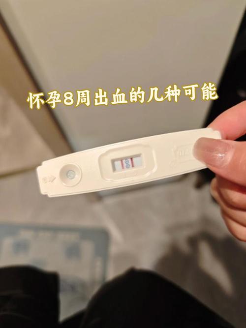 怀孕期间出现阴道出血是正常现象吗？需要警惕哪些异常情况？-第3张图片-郑州医学网