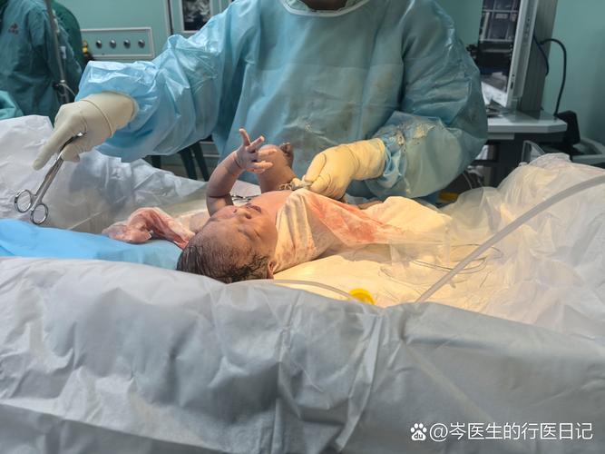 新生儿肠重复畸形手术的时机、风险及术后护理该注意什么？-第2张图片-郑州医学网