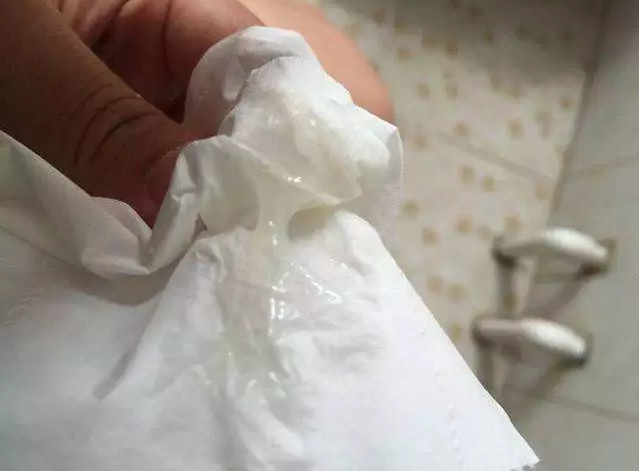 孕期有豆腐渣样分泌物-第1张图片-郑州医学网 孕期有豆腐渣样分泌物-第1张图片-郑州医学网