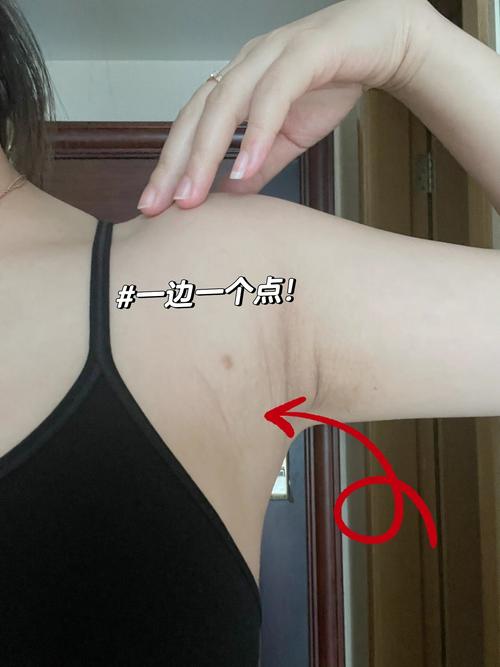 怀孕期间长副乳是什么原因？图片显示是否正常需要处理吗？-第2张图片-郑州医学网