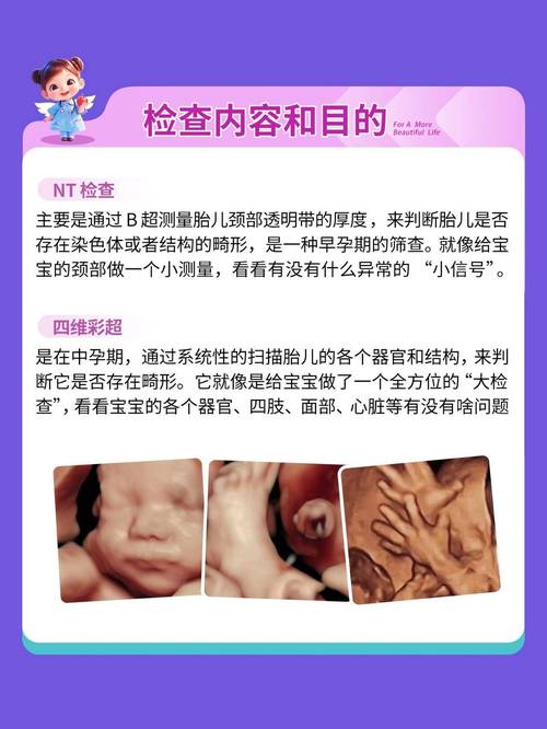 孕期大排畸和四维彩超究竟有什么不同？检查时间、范围和侧重点分别是什么？-第3张图片-郑州医学网