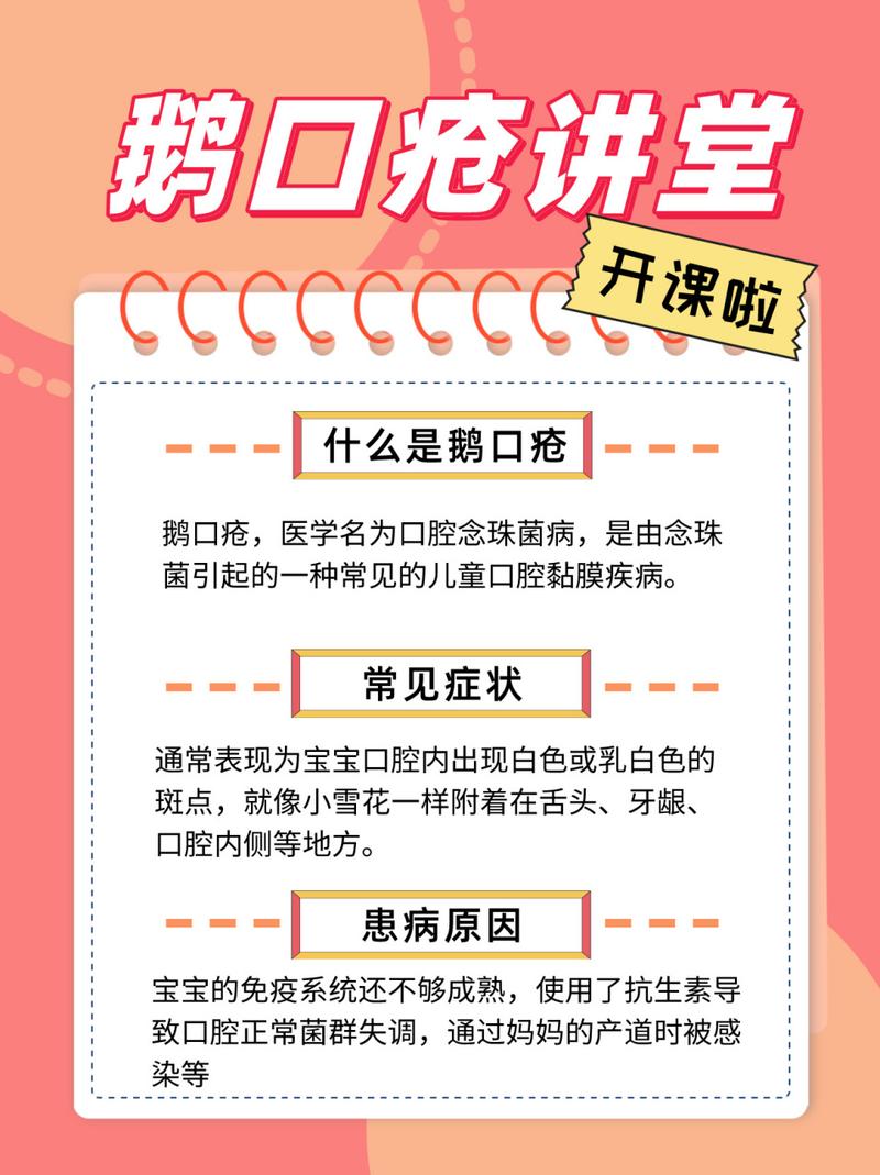 新生儿鹅口疮反复发作怎么办?日常护理有哪些关键点?-第3张图片-郑州医学网 新生儿鹅口疮反复发作怎么办?日常护理有哪些关键点?-第3张图片-郑州医学网
