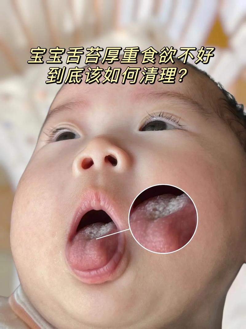 新生儿舌头总往外吐是正常现象还是异常信号？需要家长警惕哪些问题？-第2张图片-郑州医学网