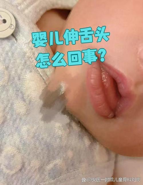 新生儿舌头总往外吐是正常现象还是异常信号？需要家长警惕哪些问题？-第3张图片-郑州医学网