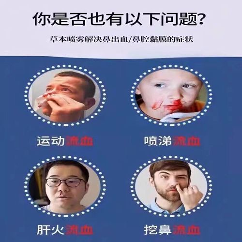 儿童用呋麻滴鼻液安全吗?剂量和注意事项有哪些?-第3张图片-郑州医学网 儿童用呋麻滴鼻液安全吗?剂量和注意事项有哪些?-第3张图片-郑州医学网