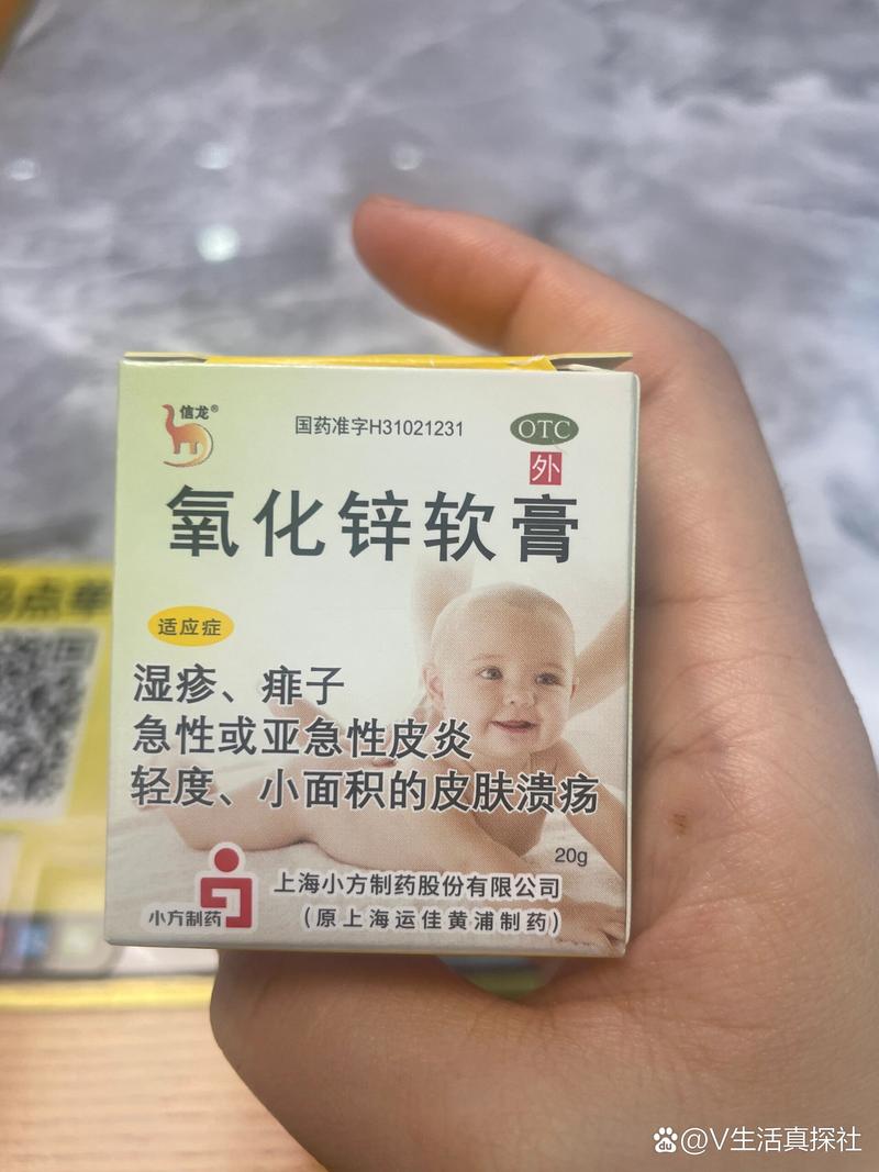 儿童脚气用什么药最好-第3张图片-郑州医学网