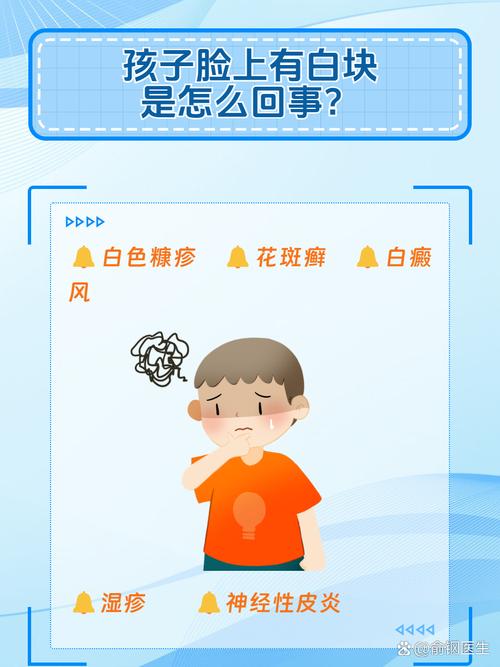 儿童脸上有白斑是缺钙还是白癜风？这些原因家长必须警惕！-第2张图片-郑州医学网