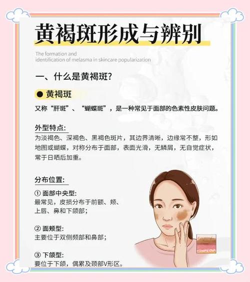 怀孕期间长斑能安全消除吗？对胎儿有影响吗？-第3张图片-郑州医学网