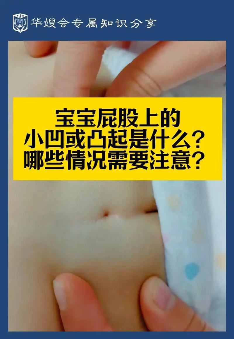 新生儿皮毛窦骶尾部该如何早期识别与干预？-第2张图片-郑州医学网