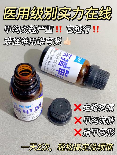 怀孕期间甲沟炎反复发作，对胎儿有影响吗？该怎么安全处理？-第2张图片-郑州医学网